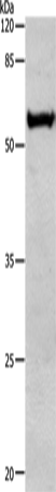 Gel: 10%SDS-PAGE<br>Lysate: 30 μg<br>Lane: Human liver cancer tissue<br>Primary antibody: TA321182 (ALDH1A1/ALDH1A2/ALDH1A3 Antibody) at dilution 1/450<br>Secondary antibody: Goat anti rabbit IgG at 1/8000 dilution<br>Exposure time: 1 minute