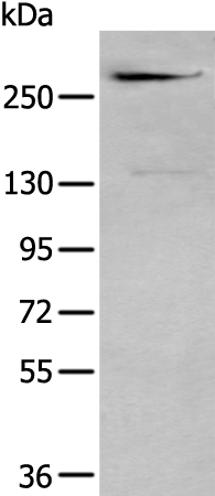 Gel: 6%SDS-PAGE<br>Lysate: 40 μg<br>Lane: A375 cell lysate<br>Primary antibody: TA371982 (CSPG4 Antibody) at dilution 1/350<br>Secondary antibody: Goat anti rabbit IgG at 1/8000 dilution<br>Exposure time: 1 minute