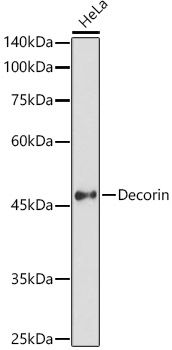 Western blot analysis of lysates from HeLa cells