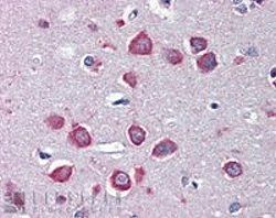 Nicotinic acetylcholine receptor alpha7 staining of paraffin embedded Human Cortex. Steamed antigen retrieval with citrate buffer pH 6, AP-staining.