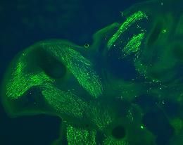 Lineage tracing of EGFP expressing migrating pectoral girdle myogenic precursors in the chicken embryos via electroporation using TOL-2-GFP plasmid system. Vibratome sections stained with anti-GFP antibody Cat.-No. TP401 show the labeled muscle fiber soft hepectoral girdle in chicken embryos at stage HH27. Data was kindly provided by: Nargis Khalida, Rizwan Rehimi: Institute of Anatomy, Dept. of Molecular Embryology, Ruhr University Bochum, Germany