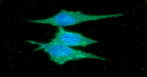 ICC/IF analysis of FABP7 in PC3 cells. The cell was stained with Human FABP7/B-FABP antibody (1:100). The secondary antibody (green) was used Alexa Fluor 488. DAPI was stained the cell nucleus (blue).