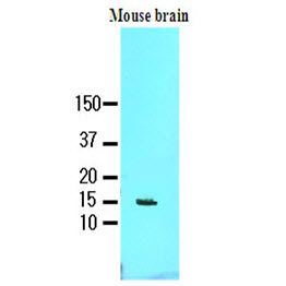 The tissue lysate of mouse brain (60ug) was resolved by SDS-PAGE, transferred to NC membrane and probed with anti-human FABP7 (1:1000). Proteins were visualized using a goat anti-mouse secondary antibody conjugated to HRP and an ECL detection system.