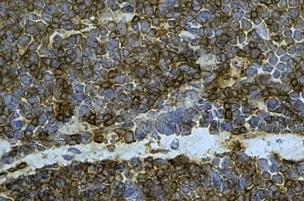 Mouse anti Bovine CD1w2 antibody, clone CC20 (<strong>MCA2058GA</strong>) used to detect CD1w2 expressing cells in an immunohistochemical analysis of acetone fixed frozen bovine thymus. Original magnification x60.