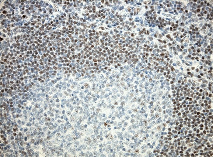Human tonsil with rabbit anti FoxP1 (clone EP137) using Polink1 (D13-6) rabbit polymer detection and HIER Accel (<a href = "https://www.origene.com/catalog/assay-kits/ihc-kits-and-reagents/b22c-125-accel-retrieval-solution-20x" title="B22C-125" class="">B22C-125</a>)for was used 10 minutes pressure cooker. Primary  antibody was incubated 1 hour; Polink-1 (D13-6) for 15 minutes and chromogen for 5 minutes according to protocol data sheet.