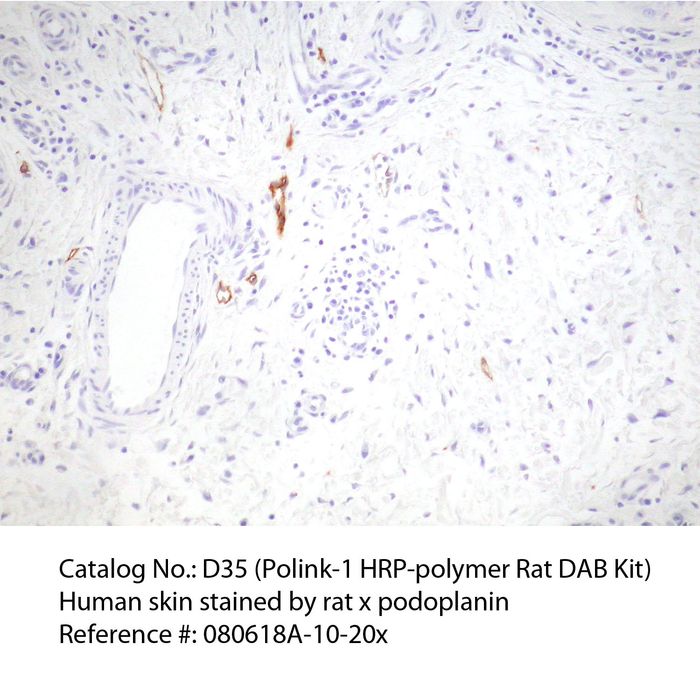 IHC staining of FFPE human skin tissue within normal limits using rat anti-podoplanin polyclonal antibody and Polink-1 HRP Rat NM for DAB detection kit D35-18. The brown stain indicates positive stain and blue is the counter stain. It is mounted using a permanent organic mounting medium E37-100.