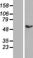 Western blot validation of overexpression lysate (Cat# <a href = "https://www.origene.com/catalog/proteins/over-expression-lysates/ly401783-smad2-nm-005901-human-over-expression-lysate" title="LY401783" class="">LY401783</a>) using anti-DDK antibody (Cat# <a href = "https://www.origene.com/catalog/antibodies/tag-antibodies/ta50011-100-clone-oti4c5-anti-ddk-flag-monoclonal-antibody" title="TA50011-100" class="">TA50011-100</a>). Left: Cell lysates from un-transfected HEK293T cells; Right: Cell lysates from HEK293T cells transfected with <a href = "https://www.origene.com/catalog/cdna-clones/expression-plasmids/rc204604-smad2-nm-005901-human-tagged-orf-clone" title="RC204604" class="">RC204604</a> using transfection reagent MegaTran 2.0 (Cat# <a href = "https://www.origene.com/catalog/others/transfection-reagents/tt210002-megatran-20-plasmid-dna-transfection-reagent-05-ml" title="TT210002" class="">TT210002</a>).