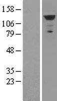 Western blot validation of overexpression lysate (Cat# LY411723) using anti-DDK antibody (Cat# <a href = "https://www.origene.com/catalog/antibodies/tag-antibodies/ta50011-100-clone-oti4c5-anti-ddk-flag-monoclonal-antibody" title="TA50011-100" class="">TA50011-100</a>). Left: Cell lysates from un-transfected HEK293T cells; Right: Cell lysates from HEK293T cells transfected with <a href = "https://www.origene.com/catalog/cdna-clones/expression-plasmids/rc215661-mda5-ifih1-nm-022168-human-tagged-orf-clone" title="RC215661" class="">RC215661</a> using transfection reagent MegaTran 2.0 (Cat# <a href = "https://www.origene.com/catalog/others/transfection-reagents/tt210002-megatran-20-plasmid-dna-transfection-reagent-05-ml" title="TT210002" class="">TT210002</a>).