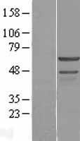 Western blot validation of overexpression lysate (Cat# <a href = "https://www.origene.com/catalog/proteins/over-expression-lysates/ly401648-smad4-nm-005359-human-over-expression-lysate" title="LY401648" class="">LY401648</a>) using anti-DDK antibody (Cat# <a href = "https://www.origene.com/catalog/antibodies/tag-antibodies/ta50011-100-clone-oti4c5-anti-ddk-flag-monoclonal-antibody" title="TA50011-100" class="">TA50011-100</a>). Left: Cell lysates from un-transfected HEK293T cells; Right: Cell lysates from HEK293T cells transfected with <a href = "https://www.origene.com/catalog/cdna-clones/expression-plasmids/rc201828-smad4-nm-005359-human-tagged-orf-clone" title="RC201828" class="">RC201828</a> using transfection reagent MegaTran 2.0 (Cat# <a href = "https://www.origene.com/catalog/others/transfection-reagents/tt210002-megatran-20-plasmid-dna-transfection-reagent-05-ml" title="TT210002" class="">TT210002</a>).