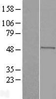 Western blot validation of overexpression lysate (Cat# LY402373) using anti-DDK antibody (Cat# <a href = "https://www.origene.com/catalog/antibodies/tag-antibodies/ta50011-100-clone-oti4c5-anti-ddk-flag-monoclonal-antibody" title="TA50011-100" class="">TA50011-100</a>). Left: Cell lysates from un-transfected HEK293T cells; Right: Cell lysates from HEK293T cells transfected with <a href = "https://www.origene.com/catalog/cdna-clones/expression-plasmids/rc203507-seladin-1-dhcr24-nm-014762-human-tagged-orf-clone" title="RC203507" class="">RC203507</a> using transfection reagent MegaTran 2.0 (Cat# <a href = "https://www.origene.com/catalog/others/transfection-reagents/tt210002-megatran-20-plasmid-dna-transfection-reagent-05-ml" title="TT210002" class="">TT210002</a>).