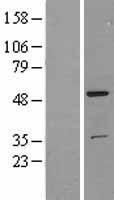 Western blot validation of overexpression lysate (Cat# LY401827) using anti-DDK antibody (Cat# <a href = "https://www.origene.com/catalog/antibodies/tag-antibodies/ta50011-100-clone-oti4c5-anti-ddk-flag-monoclonal-antibody" title="TA50011-100" class="">TA50011-100</a>). Left: Cell lysates from un-transfected HEK293T cells; Right: Cell lysates from HEK293T cells transfected with <a href = "https://www.origene.com/catalog/cdna-clones/expression-plasmids/rc201093-trk-fused-gene-tfg-nm-006070-human-tagged-orf-clone" title="RC201093" class="">RC201093</a> using transfection reagent MegaTran 2.0 (Cat# <a href = "https://www.origene.com/catalog/others/transfection-reagents/tt210002-megatran-20-plasmid-dna-transfection-reagent-05-ml" title="TT210002" class="">TT210002</a>).