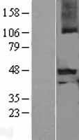 Western blot validation of overexpression lysate (Cat# <a href = "https://www.origene.com/catalog/proteins/over-expression-lysates/ly401622-myostatin-propeptide-mstn-nm-005259-human-over-expression-lysate" title="LY401622" class="">LY401622</a>) using anti-DDK antibody (Cat# <a href = "https://www.origene.com/catalog/antibodies/tag-antibodies/ta50011-100-clone-oti4c5-anti-ddk-flag-monoclonal-antibody" title="TA50011-100" class="">TA50011-100</a>). Left: Cell lysates from un-transfected HEK293T cells; Right: Cell lysates from HEK293T cells transfected with <a href = "https://www.origene.com/catalog/cdna-clones/expression-plasmids/rc210368-myostatin-propeptide-mstn-nm-005259-human-tagged-orf-clone" title="RC210368" class="">RC210368</a> using transfection reagent MegaTran 2.0 (Cat# <a href = "https://www.origene.com/catalog/others/transfection-reagents/tt210002-megatran-20-plasmid-dna-transfection-reagent-05-ml" title="TT210002" class="">TT210002</a>).