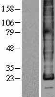 Western blot validation of overexpression lysate (Cat# <a href = "https://www.origene.com/catalog/proteins/over-expression-lysates/ly426997-plp1-nm-001128834-human-over-expression-lysate" title="LY426997" class="">LY426997</a>) using anti-DDK antibody (Cat# <a href = "https://www.origene.com/catalog/antibodies/tag-antibodies/ta50011-100-clone-oti4c5-anti-ddk-flag-monoclonal-antibody" title="TA50011-100" class="">TA50011-100</a>). Left: Cell lysates from un-transfected HEK293T cells; Right: Cell lysates from HEK293T cells transfected with <a href = "https://www.origene.com/catalog/cdna-clones/expression-plasmids/rc225379-plp1-nm-001128834-human-tagged-orf-clone" title="RC225379" class="">RC225379</a> using transfection reagent MegaTran 2.0 (Cat# <a href = "https://www.origene.com/catalog/others/transfection-reagents/tt210002-megatran-20-plasmid-dna-transfection-reagent-05-ml" title="TT210002" class="">TT210002</a>).