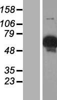 Western blot validation of overexpression lysate (Cat# <a href = "https://www.origene.com/catalog/proteins/over-expression-lysates/ly421559-glycogenin-2-gyg2-nm-001079855-human-over-expression-lysate" title="LY421559" class="">LY421559</a>) using anti-DDK antibody (Cat# <a href = "https://www.origene.com/catalog/antibodies/tag-antibodies/ta50011-100-clone-oti4c5-anti-ddk-flag-monoclonal-antibody" title="TA50011-100" class="">TA50011-100</a>). Left: Cell lysates from un-transfected HEK293T cells; Right: Cell lysates from HEK293T cells transfected with <a href = "https://www.origene.com/catalog/cdna-clones/expression-plasmids/rc202043-glycogenin-2-gyg2-nm-001079855-human-tagged-orf-clone" title="RC202043" class="">RC202043</a> using transfection reagent MegaTran 2.0 (Cat# <a href = "https://www.origene.com/catalog/others/transfection-reagents/tt210002-megatran-20-plasmid-dna-transfection-reagent-05-ml" title="TT210002" class="">TT210002</a>).