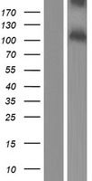 Western blot validation of overexpression lysate (Cat# <a href = "https://www.origene.com/catalog/proteins/over-expression-lysates/ly408701-pace4-pcsk6-nm-138320-human-over-expression-lysate" title="LY408701" class="">LY408701</a>) using anti-DDK antibody (Cat# <a href = "https://www.origene.com/catalog/antibodies/tag-antibodies/ta50011-100-clone-oti4c5-anti-ddk-flag-monoclonal-antibody" title="TA50011-100" class="">TA50011-100</a>). Left: Cell lysates from un-transfected HEK293T cells; Right: Cell lysates from HEK293T cells transfected with <a href = "https://www.origene.com/catalog/cdna-clones/expression-plasmids/rc213553-pace4-pcsk6-nm-138320-human-tagged-orf-clone" title="RC213553" class="">RC213553</a> using transfection reagent MegaTran 2.0 (Cat# <a href = "https://www.origene.com/catalog/others/transfection-reagents/tt210002-megatran-20-plasmid-dna-transfection-reagent-05-ml" title="TT210002" class="">TT210002</a>).