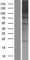 Western blot validation of overexpression lysate (Cat# <a href = "https://www.origene.com/catalog/proteins/over-expression-lysates/ly413366-pacs1-nm-018026-human-over-expression-lysate" title="LY413366" class="">LY413366</a>) using anti-DDK antibody (Cat# <a href = "https://www.origene.com/catalog/antibodies/tag-antibodies/ta50011-100-clone-oti4c5-anti-ddk-flag-monoclonal-antibody" title="TA50011-100" class="">TA50011-100</a>). Left: Cell lysates from un-transfected HEK293T cells; Right: Cell lysates from HEK293T cells transfected with RC204036 using transfection reagent MegaTran 2.0 (Cat# <a href = "https://www.origene.com/catalog/others/transfection-reagents/tt210002-megatran-20-plasmid-dna-transfection-reagent-05-ml" title="TT210002" class="">TT210002</a>).
