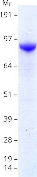 Coomassie blue staining of purified KIF20A protein (Cat# TP301100). The protein was produced from HEK293T cells transfected with KIF20A cDNA clone (Cat# <a href = "https://www.origene.com/catalog/cdna-clones/expression-plasmids/rc201100-kif20a-nm-005733-human-tagged-orf-clone" title="RC201100" class="">RC201100</a>) using MegaTran 2.0 (Cat# <a href = "https://www.origene.com/catalog/others/transfection-reagents/tt210002-megatran-20-plasmid-dna-transfection-reagent-05-ml" title="TT210002" class="">TT210002</a>).