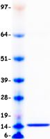 Coomassie blue staining of purified CCL2 protein (Cat# TP302180). The protein was produced from HEK293T cells transfected with CCL2 cDNA clone (Cat# <a href = "https://www.origene.com/catalog/cdna-clones/expression-plasmids/rc202180-mcp1-ccl2-nm-002982-human-tagged-orf-clone" title="RC202180" class="">RC202180</a>) using MegaTran 2.0 (Cat# <a href = "https://www.origene.com/catalog/others/transfection-reagents/tt210002-megatran-20-plasmid-dna-transfection-reagent-05-ml" title="TT210002" class="">TT210002</a>).