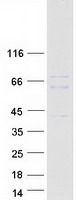 Coomassie blue staining of purified RBPJ protein (Cat# TP304791). The protein was produced from HEK293T cells transfected with RBPJ cDNA clone (Cat# <a href = "https://www.origene.com/catalog/cdna-clones/expression-plasmids/rc204791-rbpjk-rbpj-nm-203283-human-tagged-orf-clone" title="RC204791" class="">RC204791</a>) using MegaTran 2.0 (Cat# <a href = "https://www.origene.com/catalog/others/transfection-reagents/tt210002-megatran-20-plasmid-dna-transfection-reagent-05-ml" title="TT210002" class="">TT210002</a>).