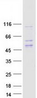 Coomassie blue staining of purified HLA-E protein (Cat# TP305939). The protein was produced from HEK293T cells transfected with HLA-E cDNA clone (Cat# <a href = "https://www.origene.com/catalog/cdna-clones/expression-plasmids/rc205939-hlae-hla-e-nm-005516-human-tagged-orf-clone" title="RC205939" class="">RC205939</a>) using MegaTran 2.0 (Cat# <a href = "https://www.origene.com/catalog/others/transfection-reagents/tt210002-megatran-20-plasmid-dna-transfection-reagent-05-ml" title="TT210002" class="">TT210002</a>).