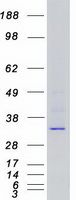 Coomassie blue staining of purified CDK6 protein (Cat# TP308560). The protein was produced from HEK293T cells transfected with CDK6 cDNA clone (Cat# <a href = "https://www.origene.com/catalog/cdna-clones/expression-plasmids/rc208560-cdk6-nm-001259-human-tagged-orf-clone" title="RC208560" class="">RC208560</a>) using MegaTran 2.0 (Cat# <a href = "https://www.origene.com/catalog/others/transfection-reagents/tt210002-megatran-20-plasmid-dna-transfection-reagent-05-ml" title="TT210002" class="">TT210002</a>).