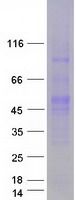 Coomassie blue staining of purified POU5F1 protein (Cat# <a href = "https://www.origene.com/catalog/proteins/recombinant-proteins/tp311998-oct4-pou5f1-nm-002701-human-recombinant-protein" title="TP311998" class="">TP311998</a>). The protein was produced from HEK293T cells transfected with POU5F1 cDNA clone (Cat# <a href = "https://www.origene.com/catalog/cdna-clones/expression-plasmids/rc211998-oct4-pou5f1-nm-002701-human-tagged-orf-clone" title="RC211998" class="">RC211998</a>) using MegaTran 2.0 (Cat# <a href = "https://www.origene.com/catalog/others/transfection-reagents/tt210002-megatran-20-plasmid-dna-transfection-reagent-05-ml" title="TT210002" class="">TT210002</a>).