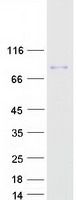 Coomassie blue staining of purified GYS2 protein (Cat# <a href = "https://www.origene.com/catalog/proteins/recombinant-proteins/tp311375-glycogen-synthase-2-gys2-nm-021957-human-recombinant-protein" title="TP311375" class="">TP311375</a>). The protein was produced from HEK293T cells transfected with GYS2 cDNA clone (Cat# <a href = "https://www.origene.com/catalog/cdna-clones/expression-plasmids/rc211375-glycogen-synthase-2-gys2-nm-021957-human-tagged-orf-clone" title="RC211375" class="">RC211375</a>) using MegaTran 2.0 (Cat# <a href = "https://www.origene.com/catalog/others/transfection-reagents/tt210002-megatran-20-plasmid-dna-transfection-reagent-05-ml" title="TT210002" class="">TT210002</a>).