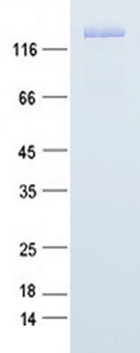 Coomassie blue staining of purified TRIM33 protein (Cat# TP312497). The protein was produced from HEK293T cells transfected with TRIM33 cDNA clone (Cat# <a href = "https://www.origene.com/catalog/cdna-clones/expression-plasmids/rc212497-tif1-gamma-trim33-nm-015906-human-tagged-orf-clone" title="RC212497" class="">RC212497</a>) using MegaTran 2.0 (Cat# <a href = "https://www.origene.com/catalog/others/transfection-reagents/tt210002-megatran-20-plasmid-dna-transfection-reagent-05-ml" title="TT210002" class="">TT210002</a>).
