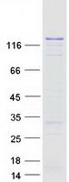 Coomassie blue staining of purified DNMT3A protein (Cat# <a href = "https://www.origene.com/catalog/proteins/recombinant-proteins/tp313064-dnmt3a-nm-022552-human-recombinant-protein" title="TP313064" class="">TP313064</a>). The protein was produced from HEK293T cells transfected with DNMT3A cDNA clone (Cat# <a href = "https://www.origene.com/catalog/cdna-clones/expression-plasmids/rc213064-dnmt3a-nm-022552-human-tagged-orf-clone" title="RC213064" class="">RC213064</a>) using MegaTran 2.0 (Cat# <a href = "https://www.origene.com/catalog/others/transfection-reagents/tt210002-megatran-20-plasmid-dna-transfection-reagent-05-ml" title="TT210002" class="">TT210002</a>).