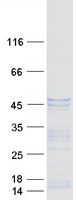 Coomassie blue staining of purified DCX protein (Cat# <a href = "https://www.origene.com/catalog/proteins/recombinant-proteins/tp316349-doublecortin-dcx-nm-178151-human-recombinant-protein" title="TP316349" class="">TP316349</a>). The protein was produced from HEK293T cells transfected with DCX cDNA clone (Cat# <a href = "https://www.origene.com/catalog/cdna-clones/expression-plasmids/rc216349-doublecortin-dcx-nm-178151-human-tagged-orf-clone" title="RC216349" class="">RC216349</a>) using MegaTran 2.0 (Cat# <a href = "https://www.origene.com/catalog/others/transfection-reagents/tt210002-megatran-20-plasmid-dna-transfection-reagent-05-ml" title="TT210002" class="">TT210002</a>).