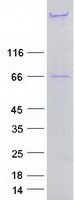 Coomassie blue staining of purified NES protein (Cat# TP318197). The protein was produced from HEK293T cells transfected with NES cDNA clone (Cat# <a href = "https://www.origene.com/catalog/cdna-clones/expression-plasmids/rc218197-nestin-nes-nm-006617-human-tagged-orf-clone" title="RC218197" class="">RC218197</a>) using MegaTran 2.0 (Cat# <a href = "https://www.origene.com/catalog/others/transfection-reagents/tt210002-megatran-20-plasmid-dna-transfection-reagent-05-ml" title="TT210002" class="">TT210002</a>).