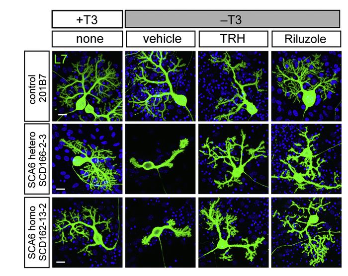TRH enhances the survival and dendritic maintenance of SCA6 Purkinje cells. High-magnification images are L7+ Purkinje cells in green derived from control, heterozygous, and homozygous iPSCs on culture day 75 in the presence or absence of T3 and with or without TRH 1 (OriGene TP319231) or Riluzole. The scale bars represent 20 um. Figure cited from Cell Rep, PMID: 27806289