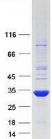 Coomassie blue staining of purified TRH protein (Cat# <a href = "https://www.origene.com/catalog/proteins/recombinant-proteins/tp319231-thyrotropin-releasing-hormone-trh-nm-007117-human-recombinant-protein" title="TP319231" class="">TP319231</a>). The protein was produced from HEK293T cells transfected with TRH cDNA clone (Cat# <a href = "https://www.origene.com/catalog/cdna-clones/expression-plasmids/rc219231-thyrotropin-releasing-hormone-trh-nm-007117-human-tagged-orf-clone" title="RC219231" class="">RC219231</a>) using MegaTran 2.0 (Cat# <a href = "https://www.origene.com/catalog/others/transfection-reagents/tt210002-megatran-20-plasmid-dna-transfection-reagent-05-ml" title="TT210002" class="">TT210002</a>).