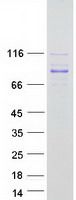 Coomassie blue staining of purified MYSM1 protein (Cat# TP320811). The protein was produced from HEK293T cells transfected with MYSM1 cDNA clone (Cat# <a href = "https://www.origene.com/catalog/cdna-clones/expression-plasmids/rc220811-mysm1-nm-001085487-human-tagged-orf-clone" title="RC220811" class="">RC220811</a>) using MegaTran 2.0 (Cat# <a href = "https://www.origene.com/catalog/others/transfection-reagents/tt210002-megatran-20-plasmid-dna-transfection-reagent-05-ml" title="TT210002" class="">TT210002</a>).