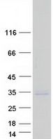 Coomassie blue staining of purified PMEPA1 protein (Cat# TP320162). The protein was produced from HEK293T cells transfected with PMEPA1 cDNA clone (Cat# <a href = "https://www.origene.com/catalog/cdna-clones/expression-plasmids/rc220162-tmepai-pmepa1-nm-199170-human-tagged-orf-clone" title="RC220162" class="">RC220162</a>) using MegaTran 2.0 (Cat# <a href = "https://www.origene.com/catalog/others/transfection-reagents/tt210002-megatran-20-plasmid-dna-transfection-reagent-05-ml" title="TT210002" class="">TT210002</a>).