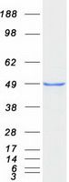 Coomassie blue staining of purified DCX protein (Cat# <a href = "https://www.origene.com/catalog/proteins/recombinant-proteins/tp321891-doublecortin-dcx-nm-178152-human-recombinant-protein" title="TP321891" class="">TP321891</a>). The protein was produced from HEK293T cells transfected with DCX cDNA clone (Cat# <a href = "https://www.origene.com/catalog/cdna-clones/expression-plasmids/rc221891-doublecortin-dcx-nm-178152-human-tagged-orf-clone" title="RC221891" class="">RC221891</a>) using MegaTran 2.0 (Cat# <a href = "https://www.origene.com/catalog/others/transfection-reagents/tt210002-megatran-20-plasmid-dna-transfection-reagent-05-ml" title="TT210002" class="">TT210002</a>).