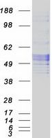 Coomassie blue staining of purified SERPINC1 protein (Cat# TP322845). The protein was produced from HEK293T cells transfected with SERPINC1 cDNA clone (Cat# <a href = "https://www.origene.com/catalog/cdna-clones/expression-plasmids/rc222845-antithrombin-iii-serpinc1-nm-000488-human-tagged-orf-clone" title="RC222845" class="">RC222845</a>) using MegaTran 2.0 (Cat# <a href = "https://www.origene.com/catalog/others/transfection-reagents/tt210002-megatran-20-plasmid-dna-transfection-reagent-05-ml" title="TT210002" class="">TT210002</a>).