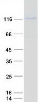 Coomassie blue staining of purified ZNF217 protein (Cat# <a href = "https://www.origene.com/catalog/proteins/recombinant-proteins/tp324371-znf217-nm-006526-human-recombinant-protein" title="TP324371" class="">TP324371</a>). The protein was produced from HEK293T cells transfected with ZNF217 cDNA clone (Cat# <a href = "https://www.origene.com/catalog/cdna-clones/expression-plasmids/rc224371-znf217-nm-006526-human-tagged-orf-clone" title="RC224371" class="">RC224371</a>) using MegaTran 2.0 (Cat# <a href = "https://www.origene.com/catalog/others/transfection-reagents/tt210002-megatran-20-plasmid-dna-transfection-reagent-05-ml" title="TT210002" class="">TT210002</a>).