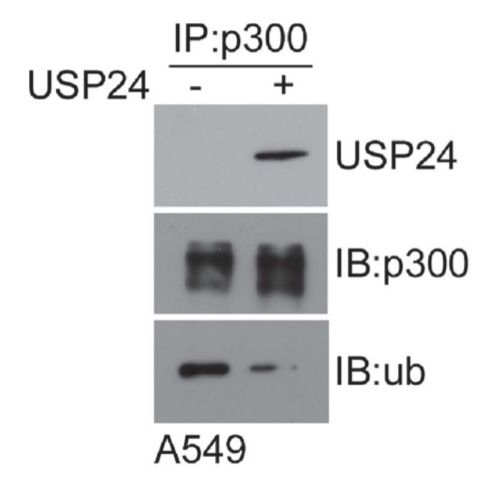 USP24 decreases the p300 ubiquitination. A549 cell lysates were immunoprecipitated with an anti-p300 antibody. IP samples were used to perform the in vitro deubiquitination assay with recombinant human USP24 (50 ug/ml) (OriGene TP329472) and USP24, p300. Ubiquitinated p300 levels were evaluated in Western blot with antibodies against the indicated proteins. Figure cited from Oncogene, PMID: 27991932