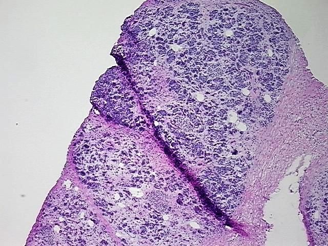 4x Image