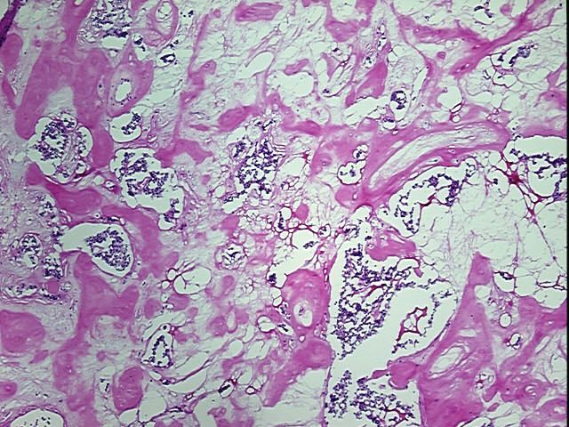 4x Image