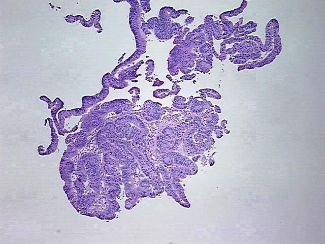 4x Image