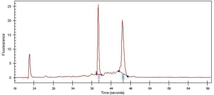 RNA Electropherogram Image