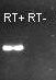 RNA RT-PCR Image