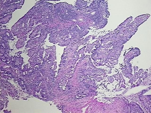 4x Image