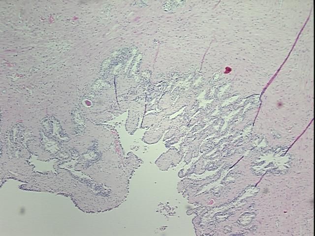 4x Image
