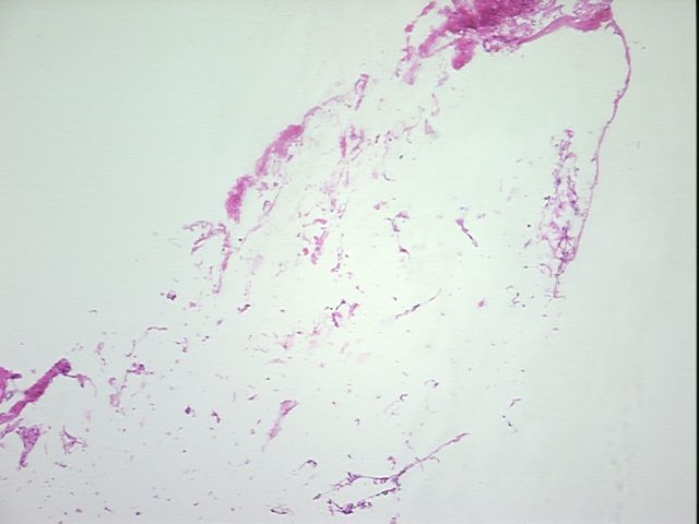4x Image