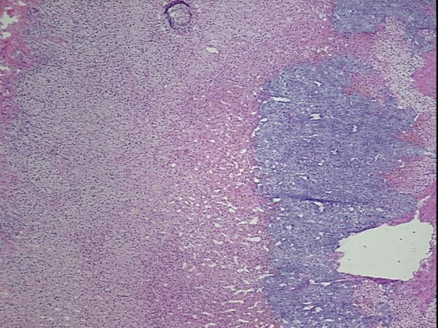 4x Image