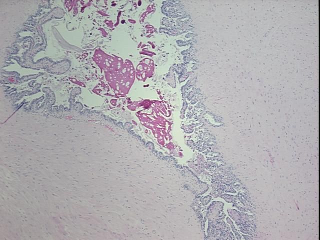 4x Image
