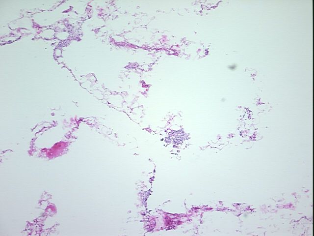 4x Image